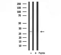 Invitrogen MRPL10 Polyclonal Antibody 100 &mu;L; Unconjugated:Antibodies,