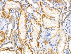 Invitrogen MRPL11 Polyclonal Antibody 100 &mu;L; Unconjugated:Antibodies,