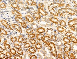 Invitrogen MRPL11 Polyclonal Antibody 100 &mu;L; Unconjugated:Antibodies,
