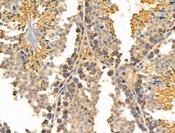Invitrogen MRPL11 Polyclonal Antibody 100 &mu;L; Unconjugated:Antibodies,