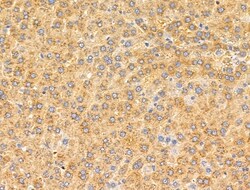 Invitrogen MRPL11 Polyclonal Antibody 100 &mu;L; Unconjugated:Antibodies,