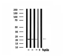 Invitrogen MRPL11 Polyclonal Antibody 100 &mu;L; Unconjugated:Antibodies,