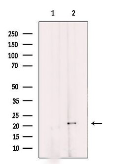 Invitrogen MRPL11 Polyclonal Antibody 100 &mu;L; Unconjugated:Antibodies,
