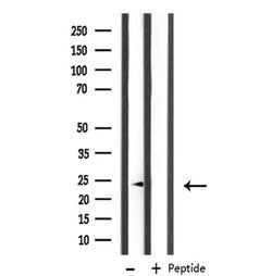Invitrogen MRPL11 Polyclonal Antibody 100 &mu;L; Unconjugated:Antibodies,