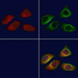 Invitrogen MRPL13 Polyclonal Antibody 100 &mu;L; Unconjugated:Antibodies,