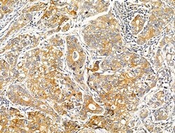 Invitrogen MRPL13 Polyclonal Antibody 100 &mu;L; Unconjugated:Antibodies,