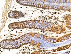 Invitrogen MRPL13 Polyclonal Antibody 100 &mu;L; Unconjugated:Antibodies,