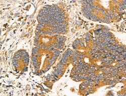 Invitrogen MRPL13 Polyclonal Antibody 100 &mu;L; Unconjugated:Antibodies,