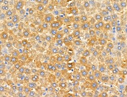 Invitrogen MRPL13 Polyclonal Antibody 100 &mu;L; Unconjugated:Antibodies,