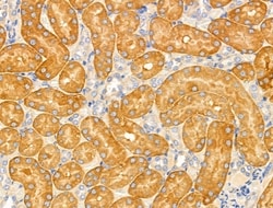 Invitrogen MRPL13 Polyclonal Antibody 100 &mu;L; Unconjugated:Antibodies,