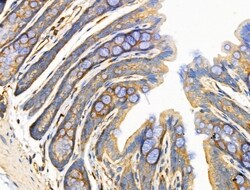 Invitrogen MRPL13 Polyclonal Antibody 100 &mu;L; Unconjugated:Antibodies,