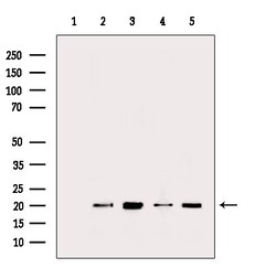 Invitrogen MRPL13 Polyclonal Antibody 100 &mu;L; Unconjugated:Antibodies,