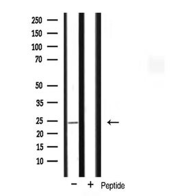 Invitrogen MRPL13 Polyclonal Antibody 100 &mu;L; Unconjugated:Antibodies,