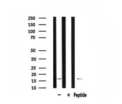 Invitrogen MRPL14 Polyclonal Antibody 100 &mu;L; Unconjugated:Antibodies,