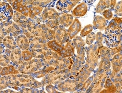 Invitrogen MRPL15 Polyclonal Antibody 100 μL; Unconjugated:Antibodies,