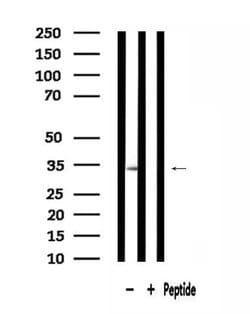 Invitrogen MRPL15 Polyclonal Antibody 100 μL; Unconjugated:Antibodies,
