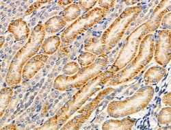 Invitrogen MRPL44 Polyclonal Antibody 100 &mu;L; Unconjugated:Antibodies,