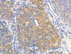 Invitrogen MRPL44 Polyclonal Antibody 100 &mu;L; Unconjugated:Antibodies,