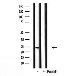 Invitrogen RPL17 Polyclonal Antibody 100 &mu;L; Unconjugated:Antibodies,
