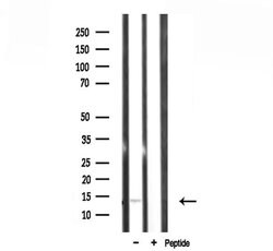 Invitrogen RPL34 Polyclonal Antibody 100 &mu;L; Unconjugated:Antibodies,