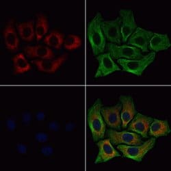 Invitrogen RPL35 Polyclonal Antibody 100 &mu;L; Unconjugated:Antibodies,