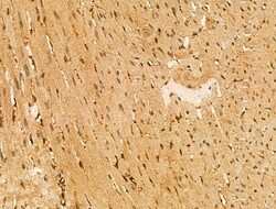 Invitrogen ABHD2 Polyclonal Antibody 100 &mu;L; Unconjugated:Antibodies,