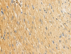 Invitrogen ABHD2 Polyclonal Antibody 100 &mu;L; Unconjugated:Antibodies,
