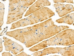 Invitrogen ABHD2 Polyclonal Antibody 100 &mu;L; Unconjugated:Antibodies,