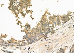 Invitrogen ABHD7 Polyclonal Antibody 100 &mu;L; Unconjugated:Antibodies,