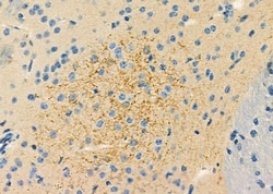 Invitrogen ABHD7 Polyclonal Antibody 100 &mu;L; Unconjugated:Antibodies,