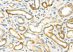 Invitrogen ABHD7 Polyclonal Antibody 100 &mu;L; Unconjugated:Antibodies,