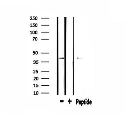 Invitrogen ABHD7 Polyclonal Antibody 100 &mu;L; Unconjugated:Antibodies,