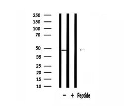 Invitrogen ABHD8 Polyclonal Antibody 100 &mu;L; Unconjugated:Antibodies,