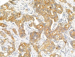 Invitrogen ACOT4 Polyclonal Antibody 100 &mu;L; Unconjugated:Antibodies,