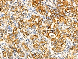 Invitrogen ACOT4 Polyclonal Antibody 100 &mu;L; Unconjugated:Antibodies,
