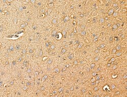 Invitrogen ACOT4 Polyclonal Antibody 100 &mu;L; Unconjugated:Antibodies,