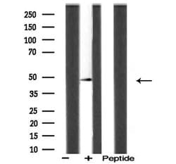 Invitrogen ACOT4 Polyclonal Antibody 100 &mu;L; Unconjugated:Antibodies,