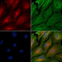 Invitrogen ADAM32 Polyclonal Antibody 100 &mu;L; Unconjugated:Antibodies,