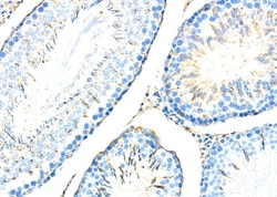 Invitrogen ADAM32 Polyclonal Antibody 100 &mu;L; Unconjugated:Antibodies,