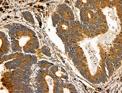 Invitrogen ADAMTS19 Polyclonal Antibody 100 &mu;L; Unconjugated:Antibodies,