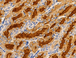 SLC25A6 Polyclonal Antibody:Antibodies, Polyclonal