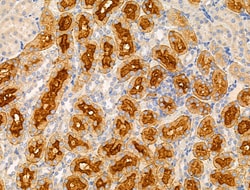 SLC25A6 Polyclonal Antibody:Antibodies, Polyclonal