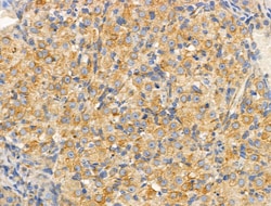 SLC25A6 Polyclonal Antibody:Antibodies, Polyclonal