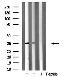 Invitrogen SLC25A31 Polyclonal Antibody 100 &mu;L; Unconjugated:Antibodies,