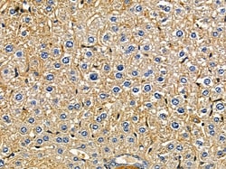 Invitrogen ARFGAP3 Polyclonal Antibody 100 &mu;L | Buy Online | Invitrogen&trade; | Fisher Scientific