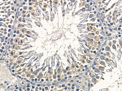 Invitrogen ARFGAP3 Polyclonal Antibody 100 &mu;L | Buy Online | Invitrogen&trade; | Fisher Scientific