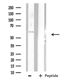 PHYKPL Polyclonal Antibody, Invitrogen 100 &mu;L; Unconjugated:Antibodies,