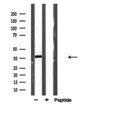 Invitrogen AKR1E2 Polyclonal Antibody 100 μL; Unconjugated:Antibodies,