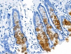 Invitrogen Alpha Sarcoglycan Polyclonal Antibody 100 &mu;L; Unconjugated:Antibodies,