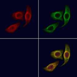 Invitrogen PAT1 Polyclonal Antibody 100 &mu;L; Unconjugated:Antibodies,